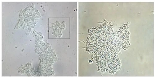 Quins factors influeixen en la formació de flocs bacterians?